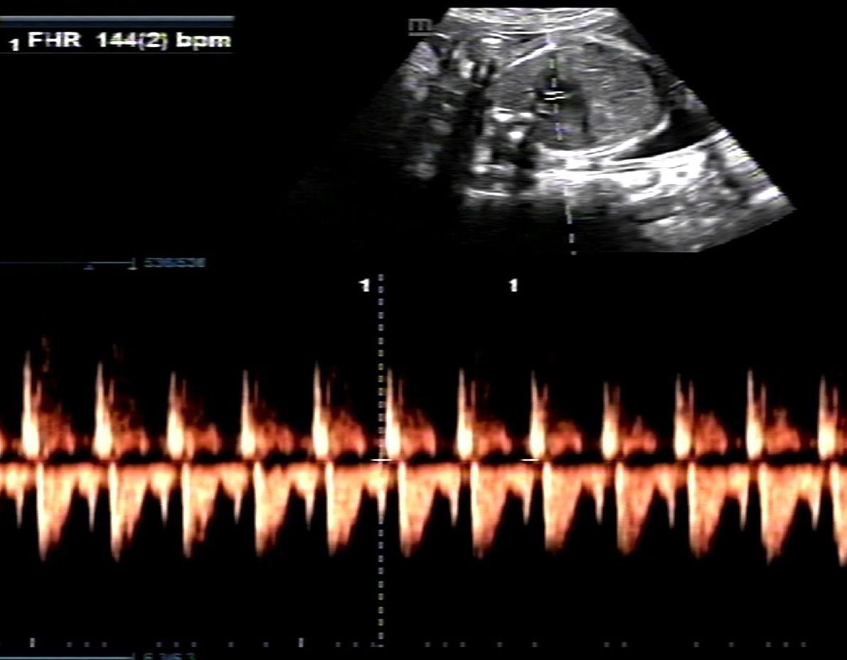 Mario López Franco-10