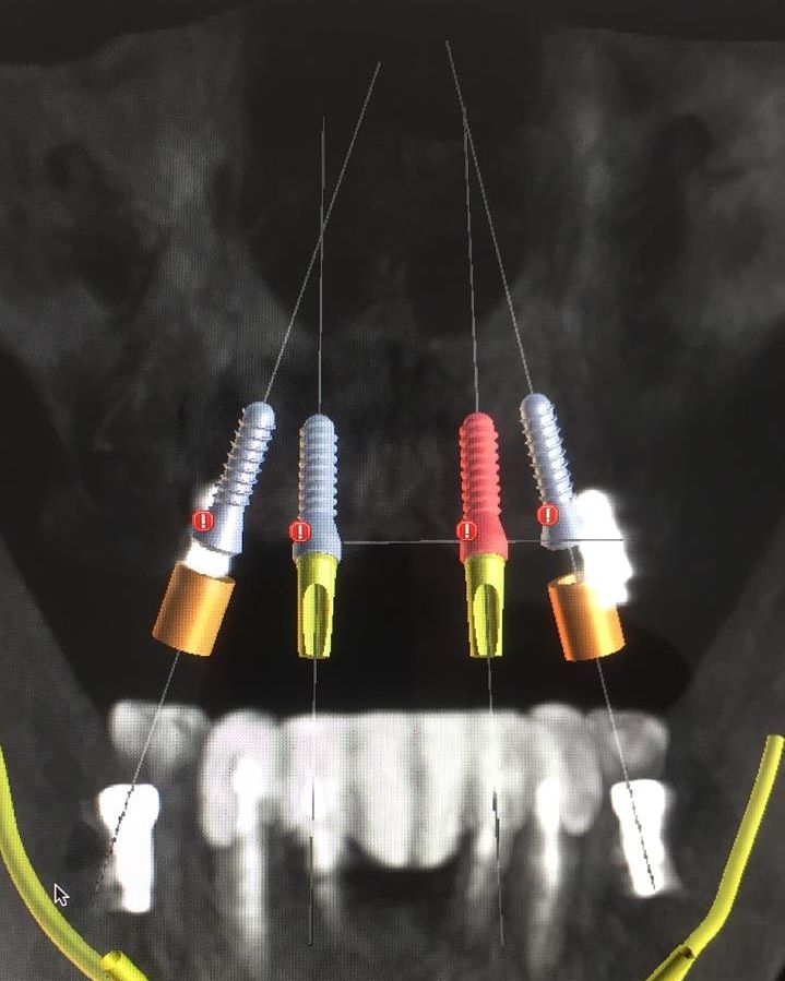 Raúl Uriel Medina Martinez-9