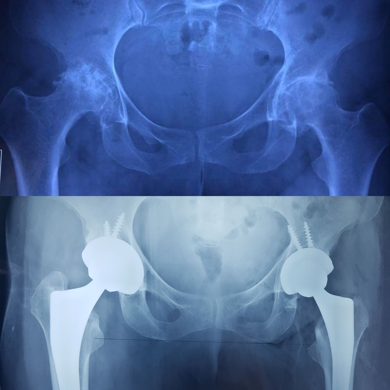 Alan Giovanni Polanco-8