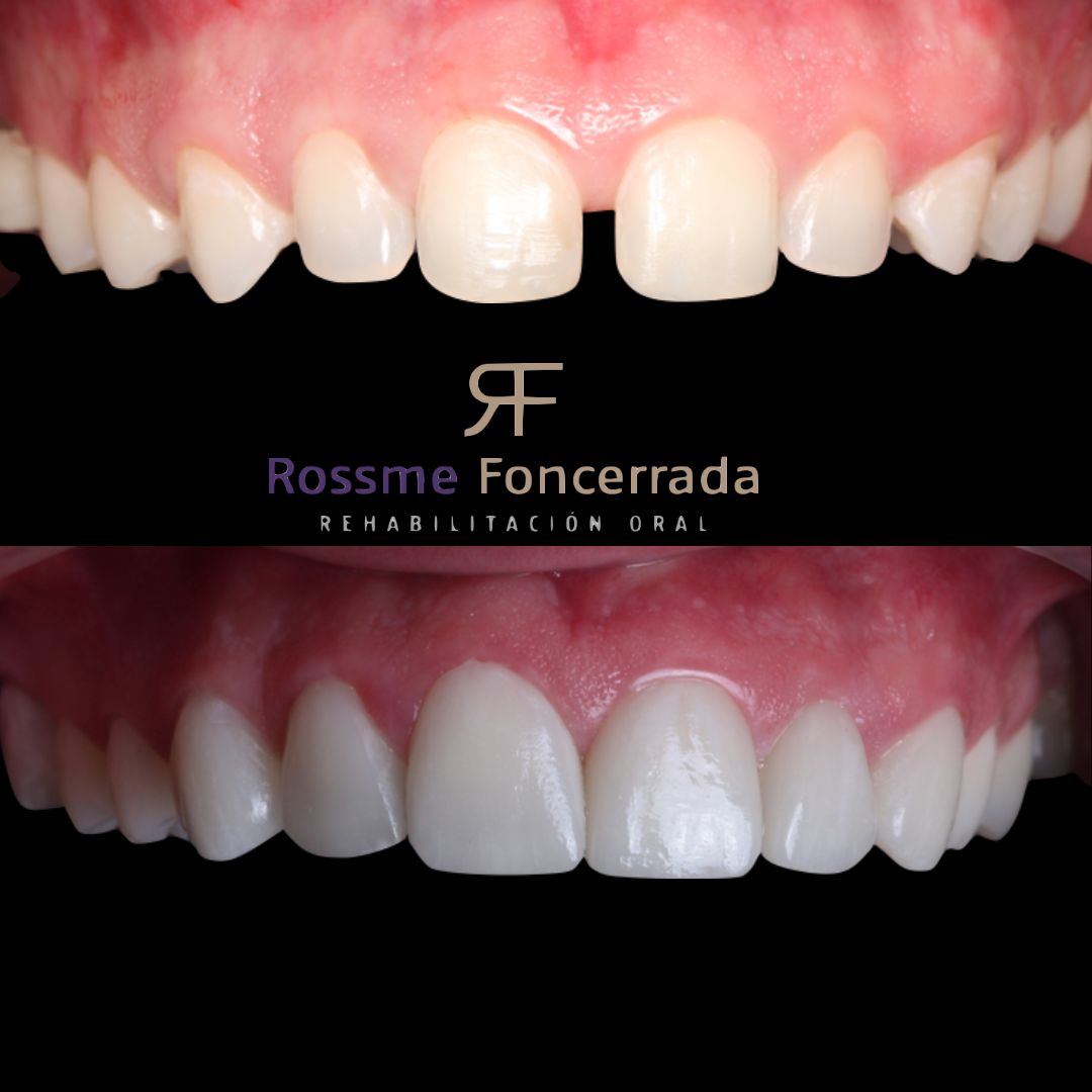 Rossme Foncerrada-3