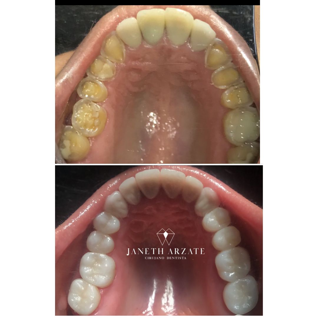 Janeth Arzate Banda-14