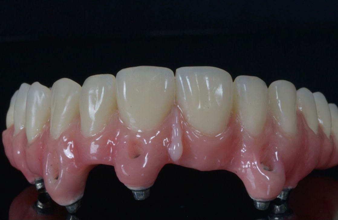 Aimee Valles Monárrez-40