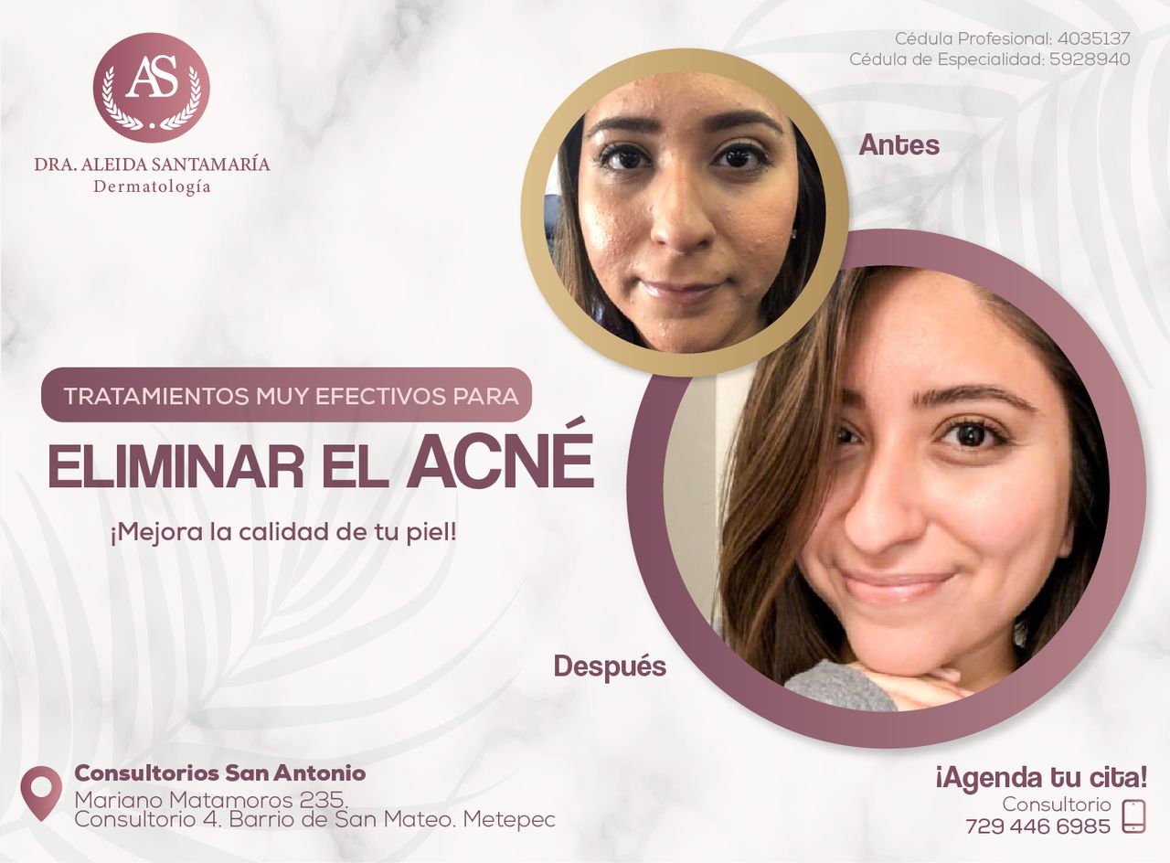 Aleida Santamaria Roman-8