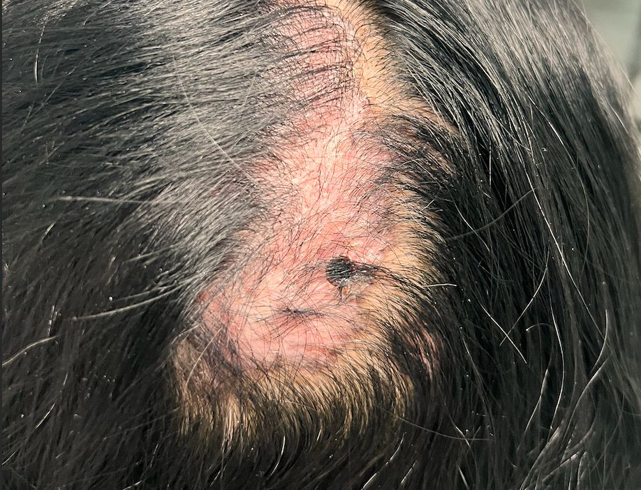 Lauro Francisco Varela Coronado-17