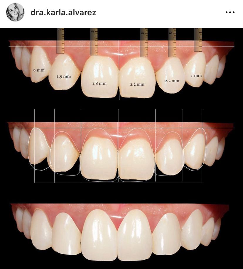 Karla Alvarez Treviño-14