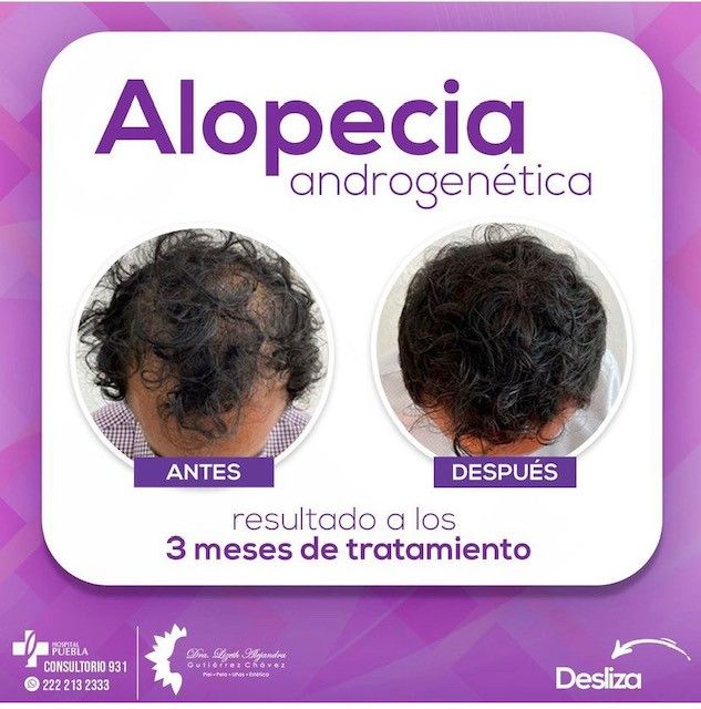 Lizeth Alejandra Gutiérrez Chavéz-7