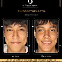 Enrique Serrano Cruz-5