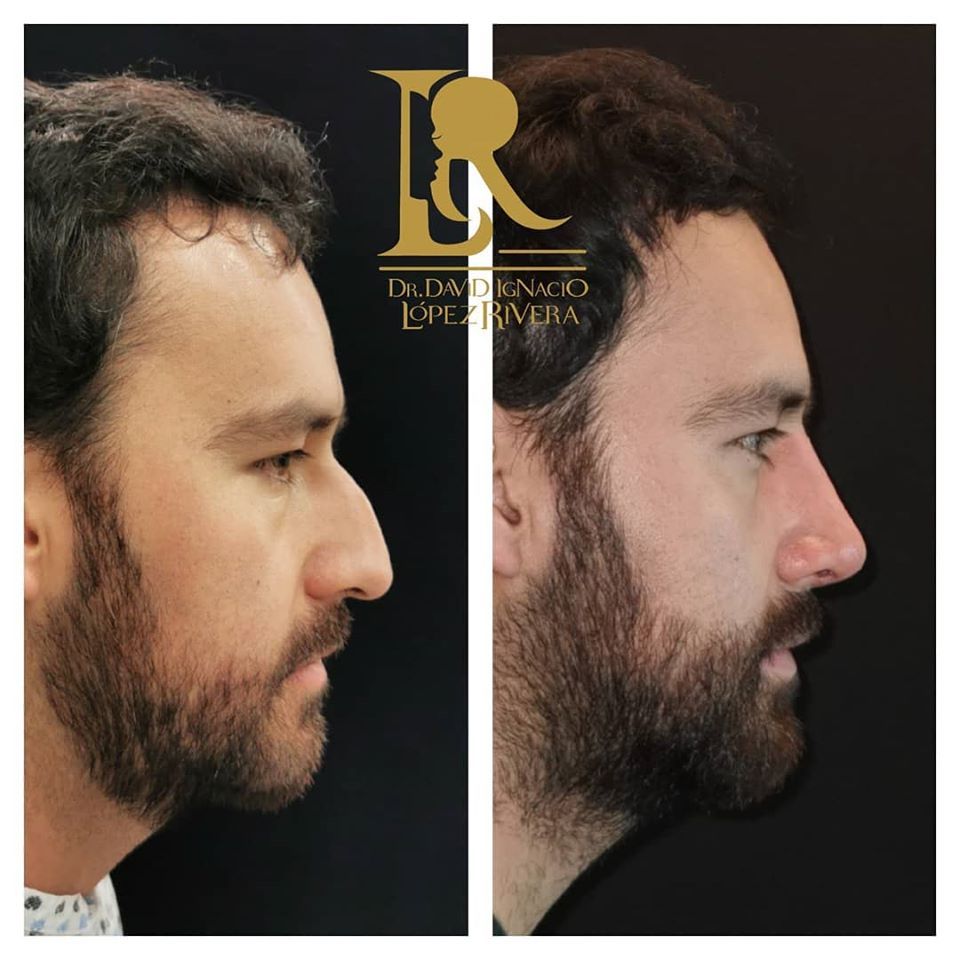 David Ignacio López Rivera-5