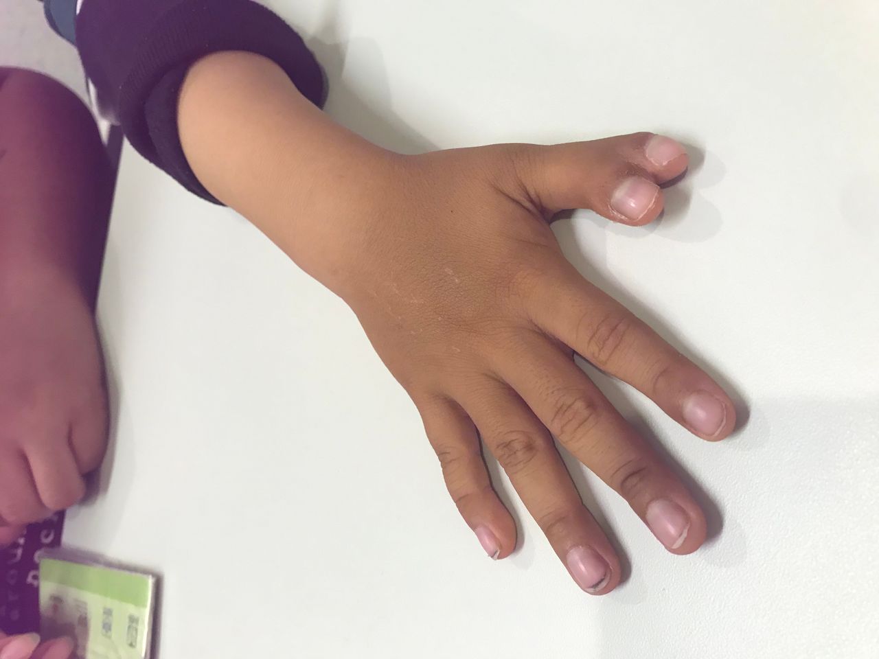 Ignacio Osvaldo Fortis Olmedo-25