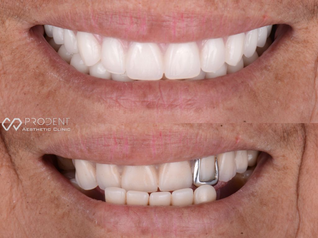 Ramiro Ivan Pérez Murillo-18