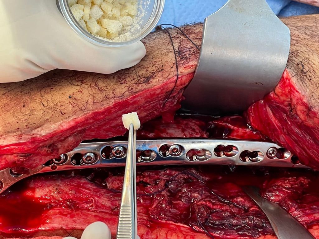 Gisela Cleto Zepeda-64