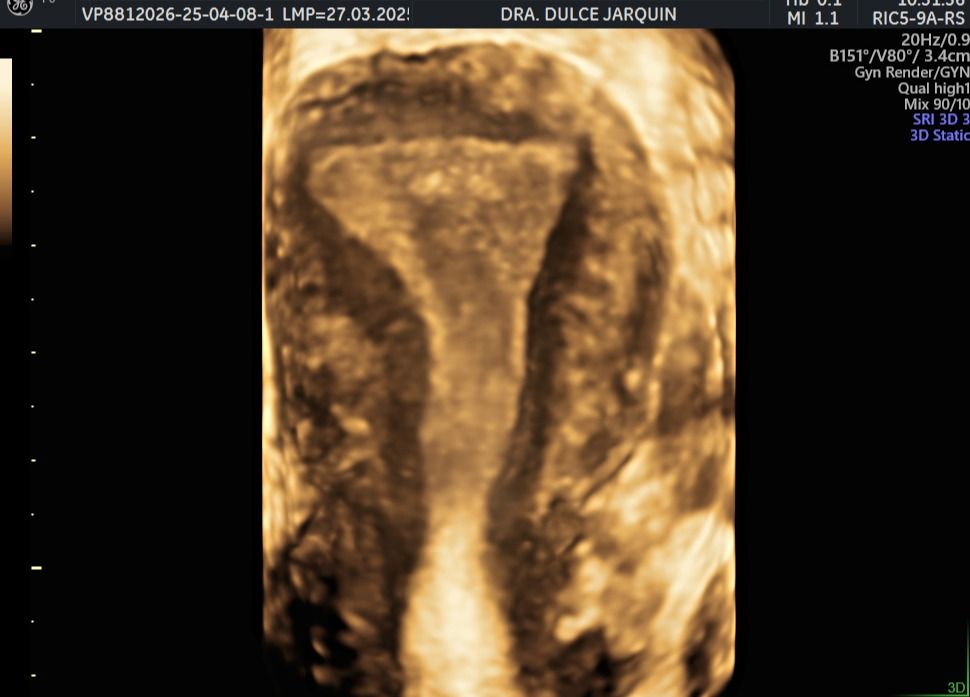 Dulce Anabel Jarquin Arango-28