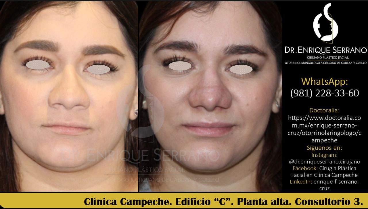 Enrique Serrano Cruz-75