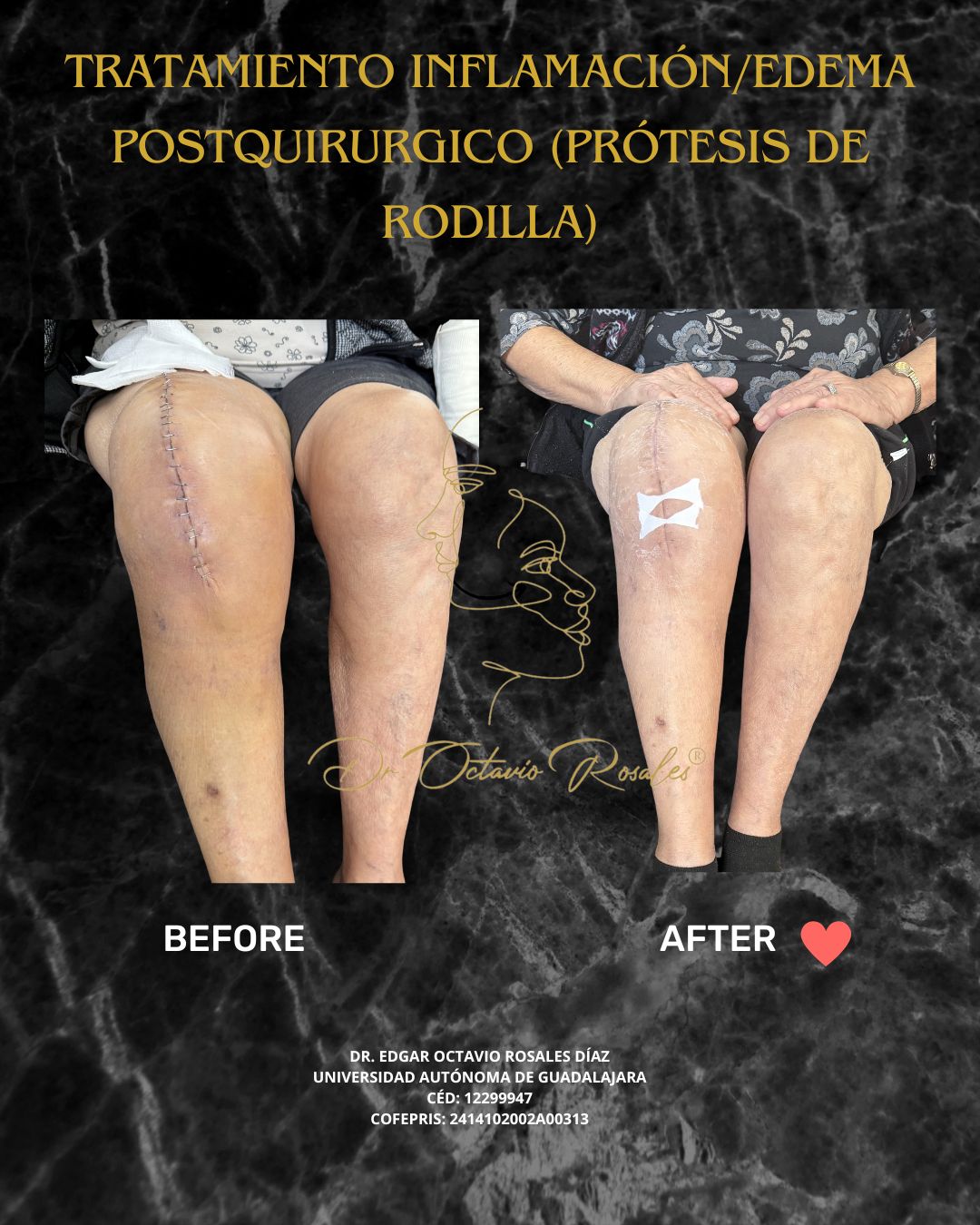 Edgar Octavio Rosales Diaz-12