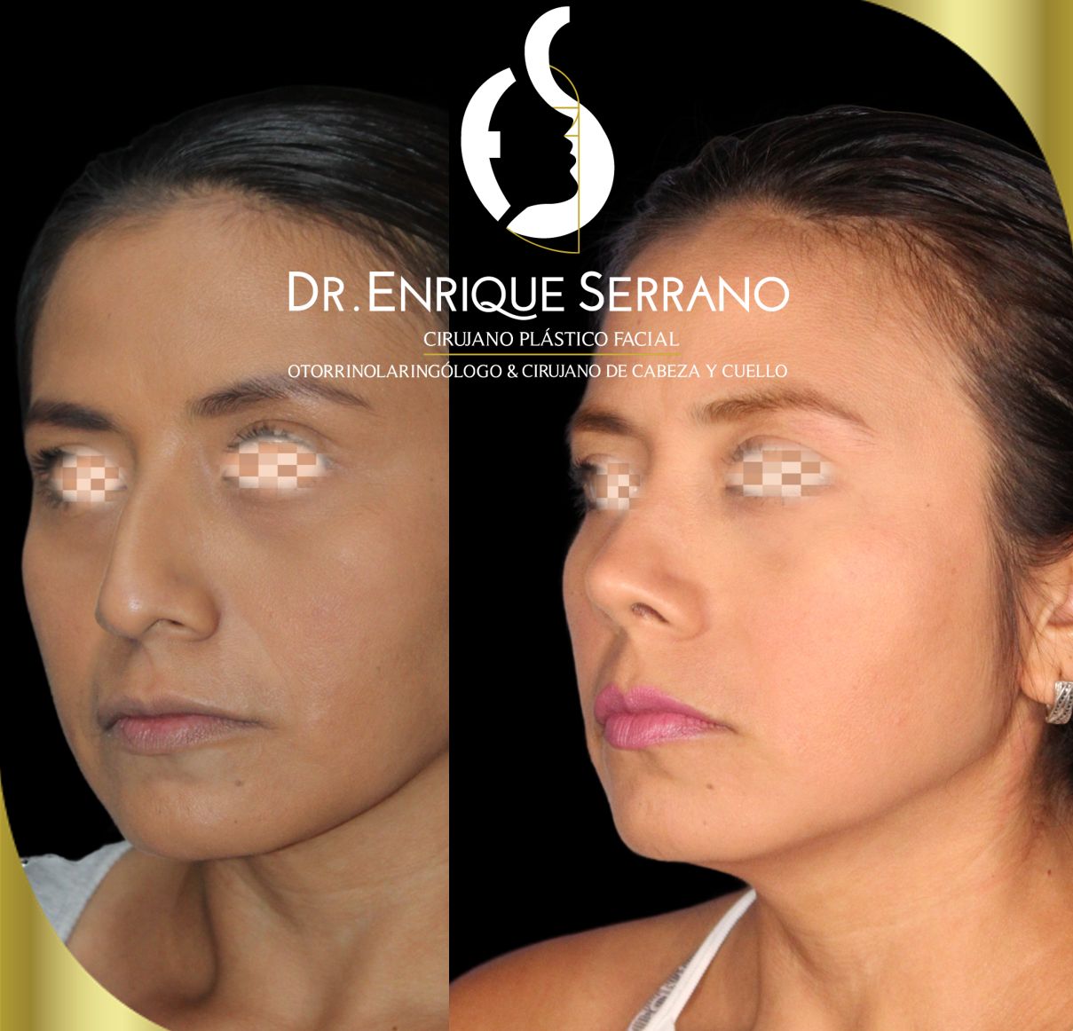 Enrique Serrano Cruz-8