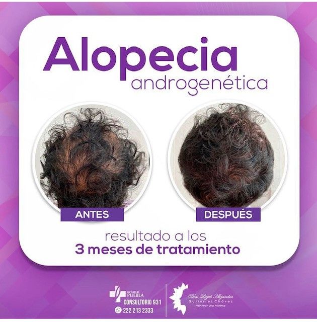 Lizeth Alejandra Gutiérrez Chavéz-9