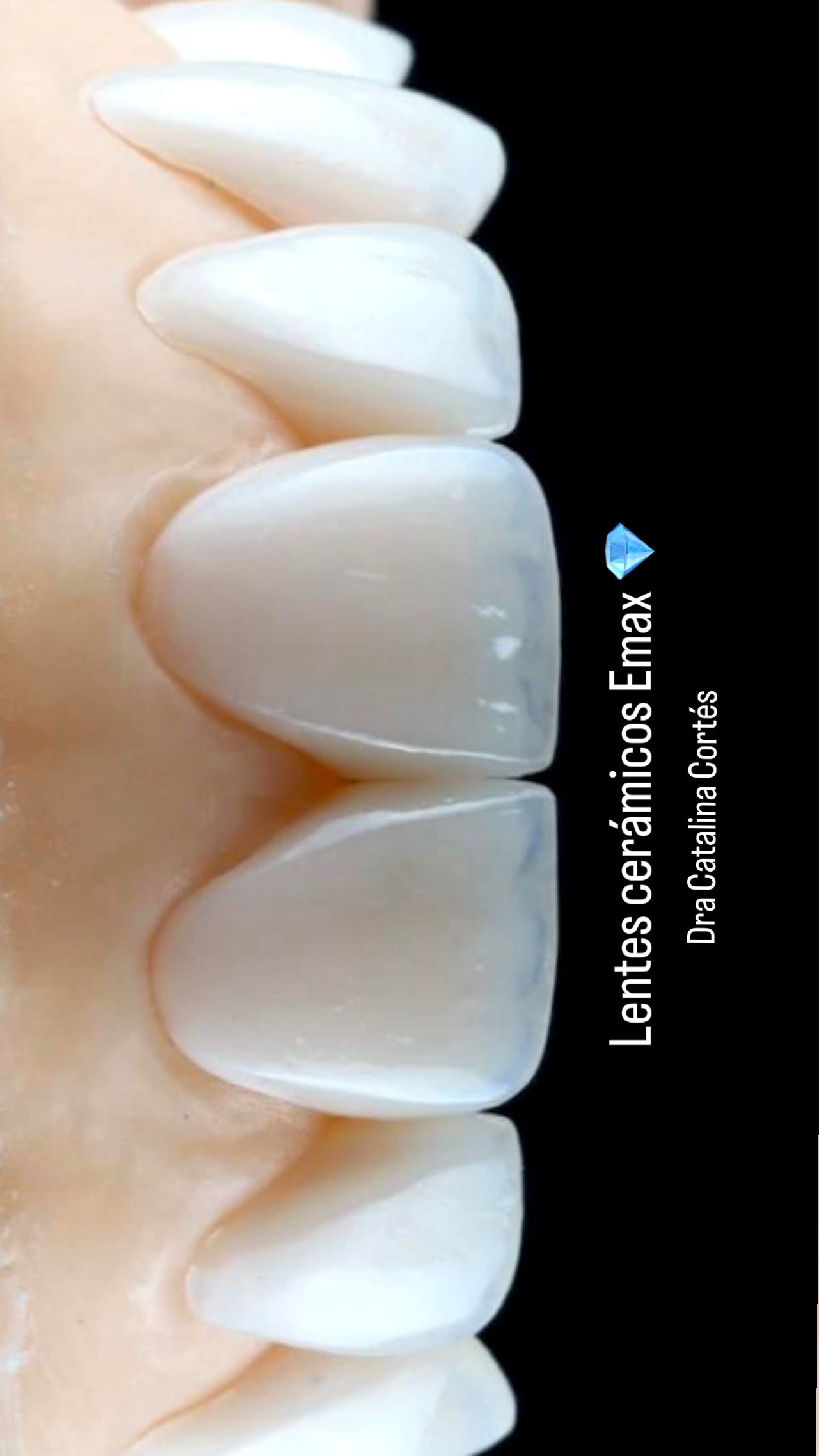 Catalina Cabezas Cortes-10