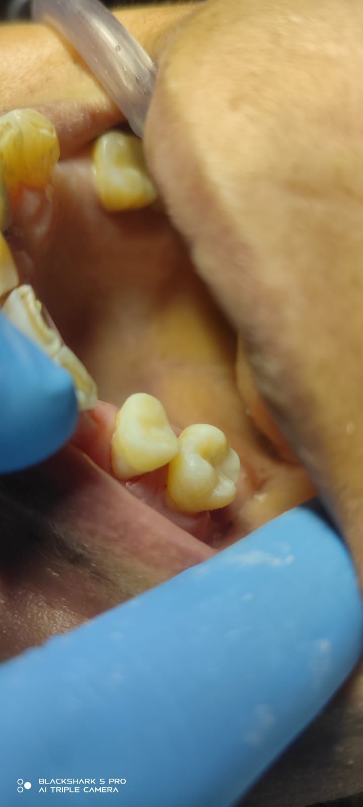 Jonathan Manuel Morán Castell-29