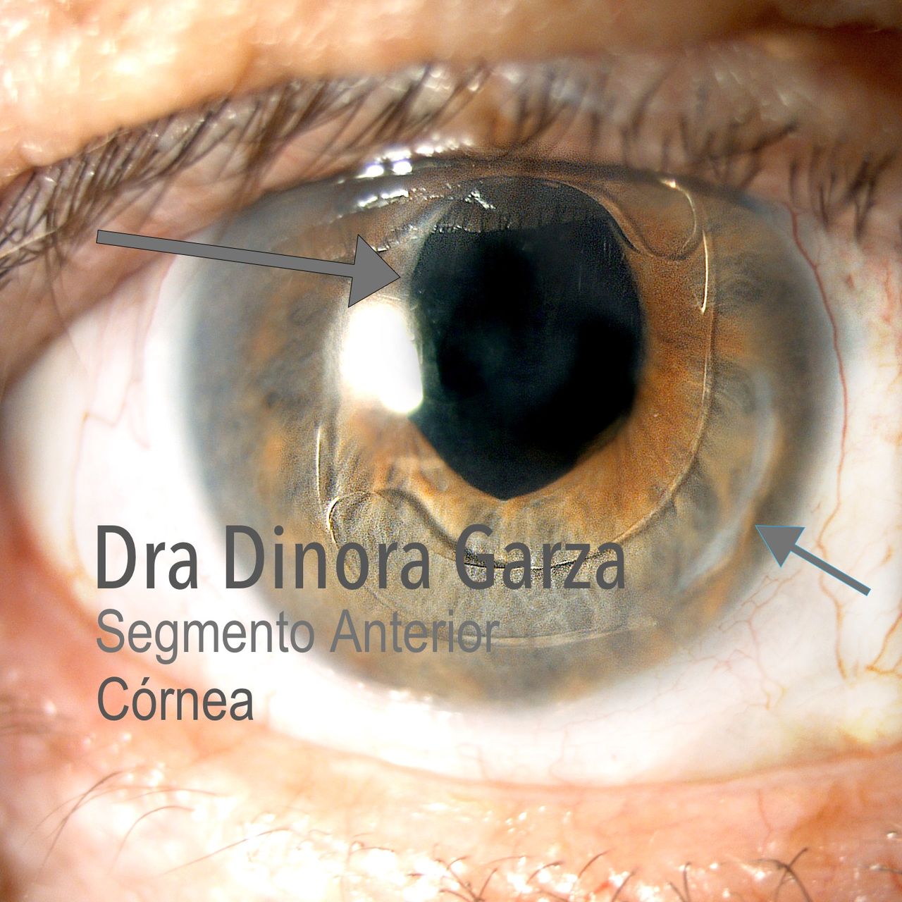 Dinora Garza Leal-25