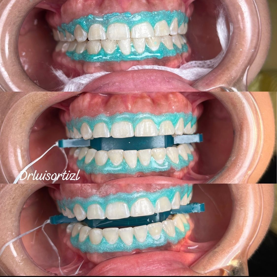 Luis Ángel Ortiz López-12