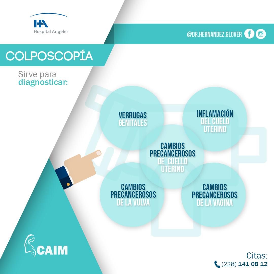 Orlando Hernandez Glover-0