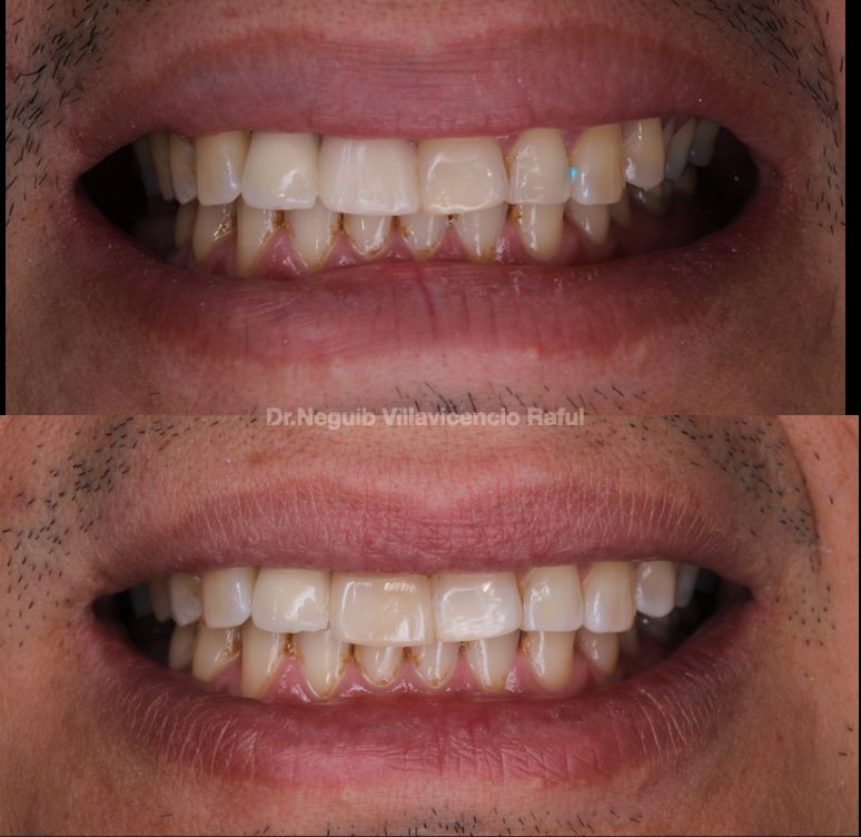 Neguib Villavicencio Raful-36