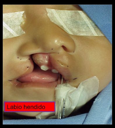 Diana Araceli Dávila Hernández-26