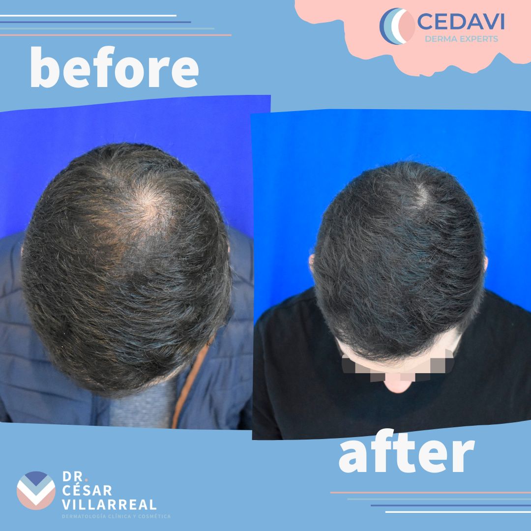 César Daniel Villarreal Villarreal-23