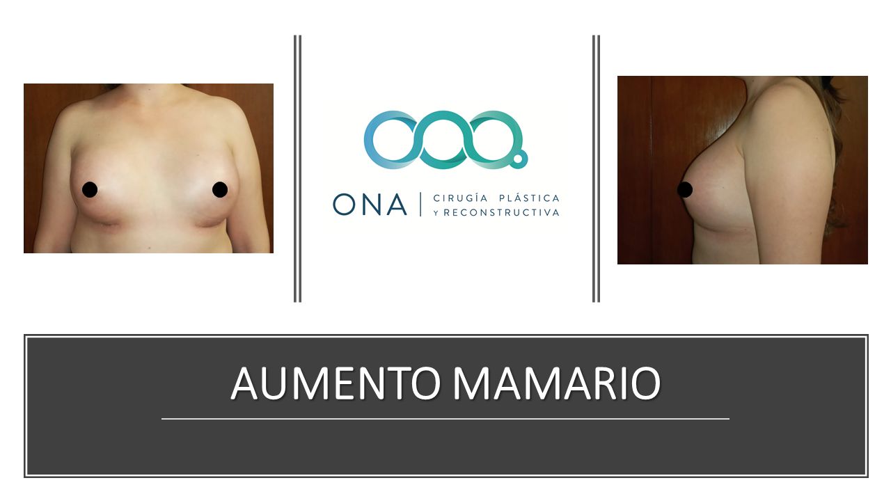 José Luis Segura Castillo-4