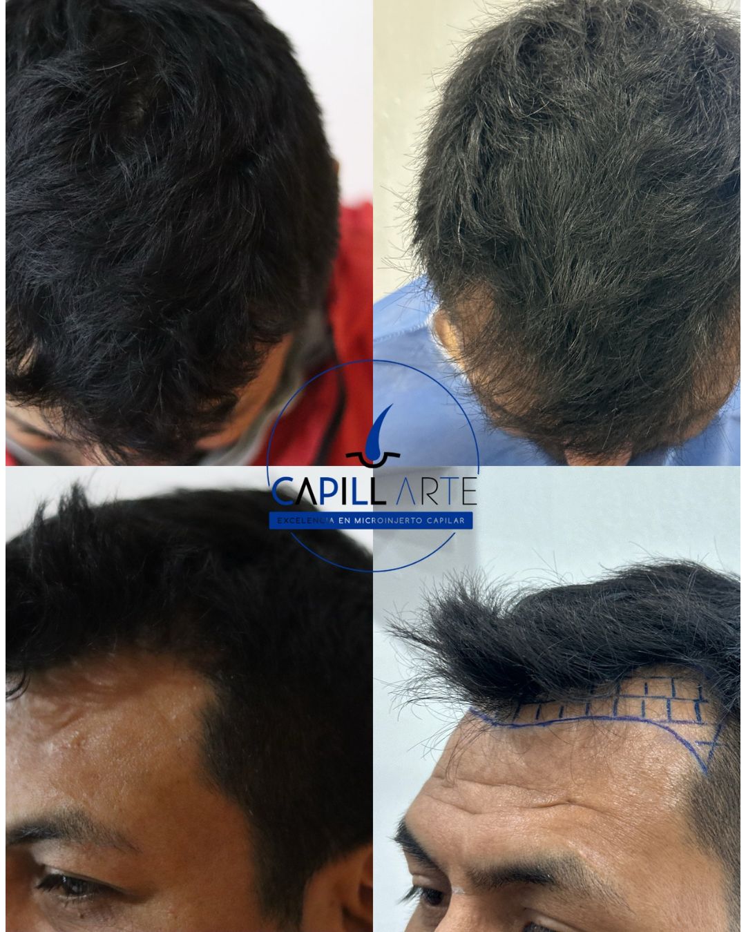 Adrian Hernandez Lopez-15