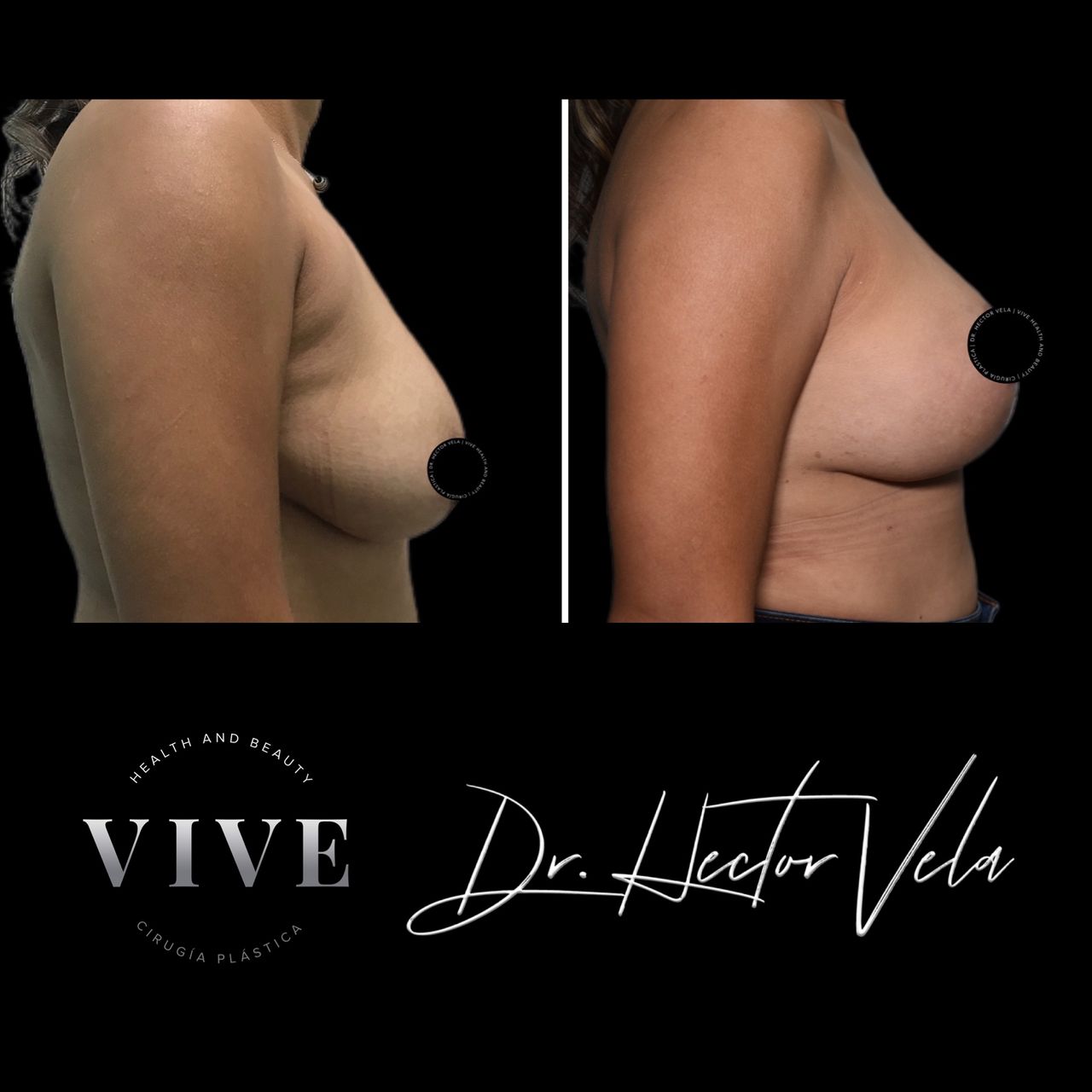 Héctor Eduardo Vela Cardona-246