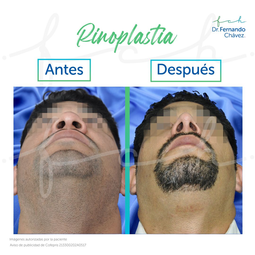 Fernando Chávez Osorio-28