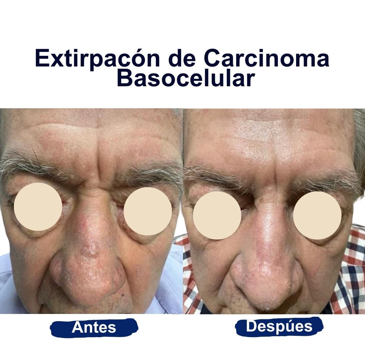 Itzel Anayn Flores Reyes-20