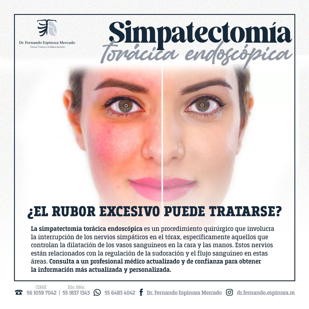 Fernando Espinoza Mercado-11