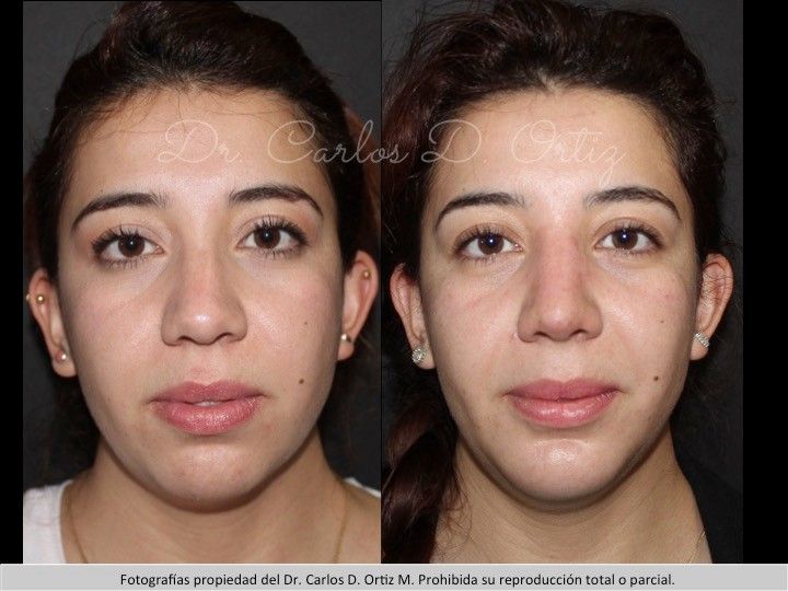 Carlos David Ortiz Moreno-62