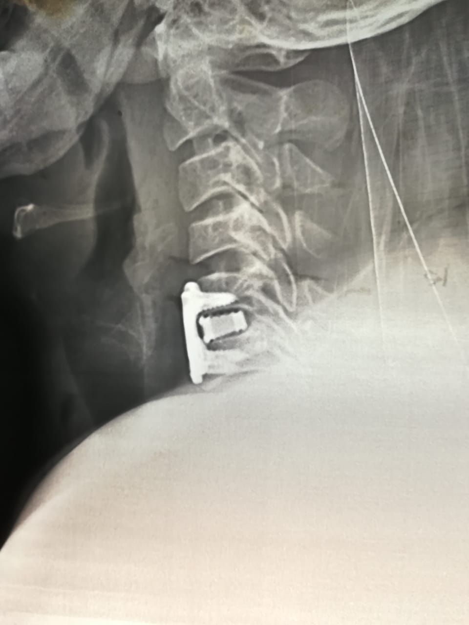 Marco Antonio Altamirano Cruz-3