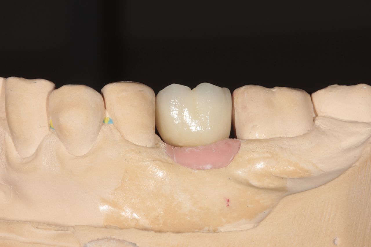 Mariel Itzayani Torres López-37