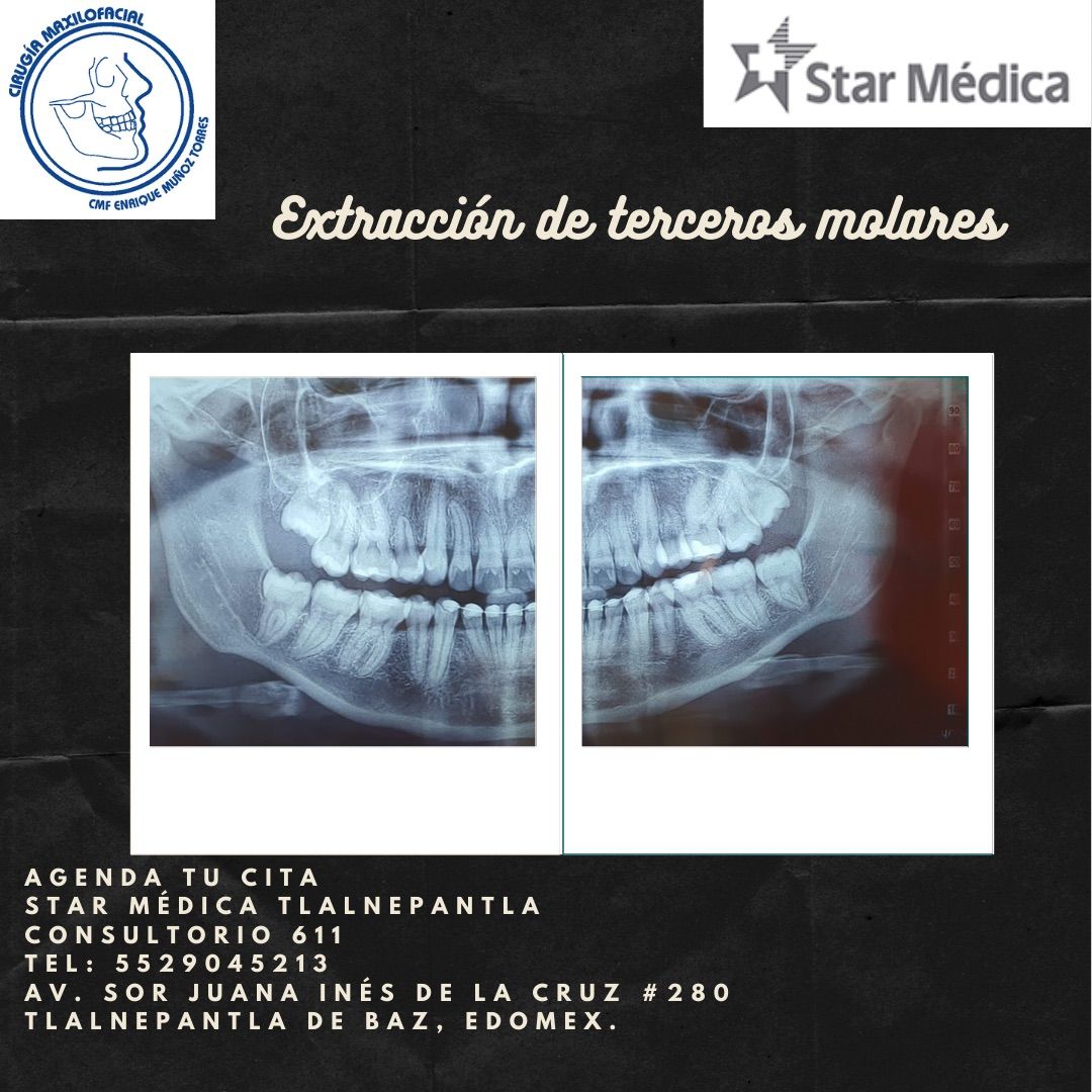 Carlos Enrique Muñoz Torres-6