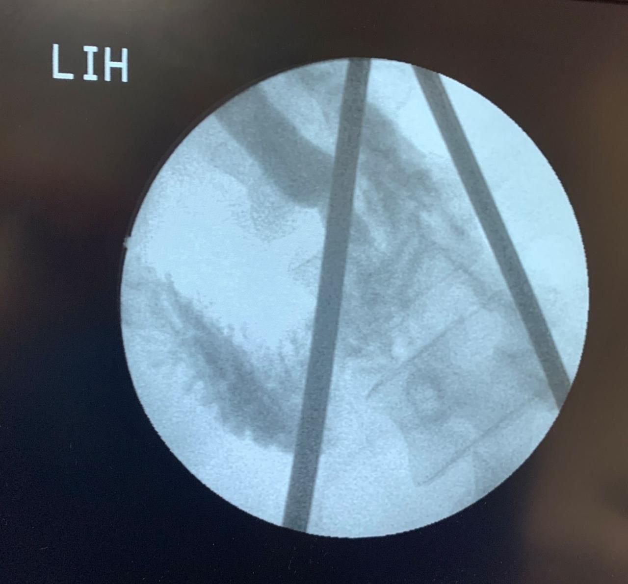 Samuel Ortiz Melendez-0