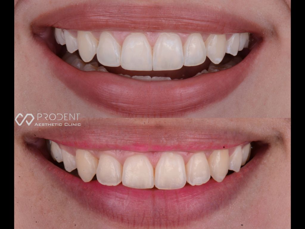 Ramiro Ivan Pérez Murillo-61