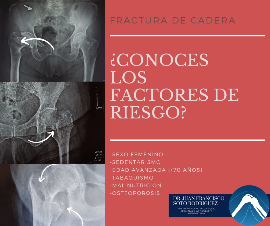 Juan Francisco Soto Rodríguez-4