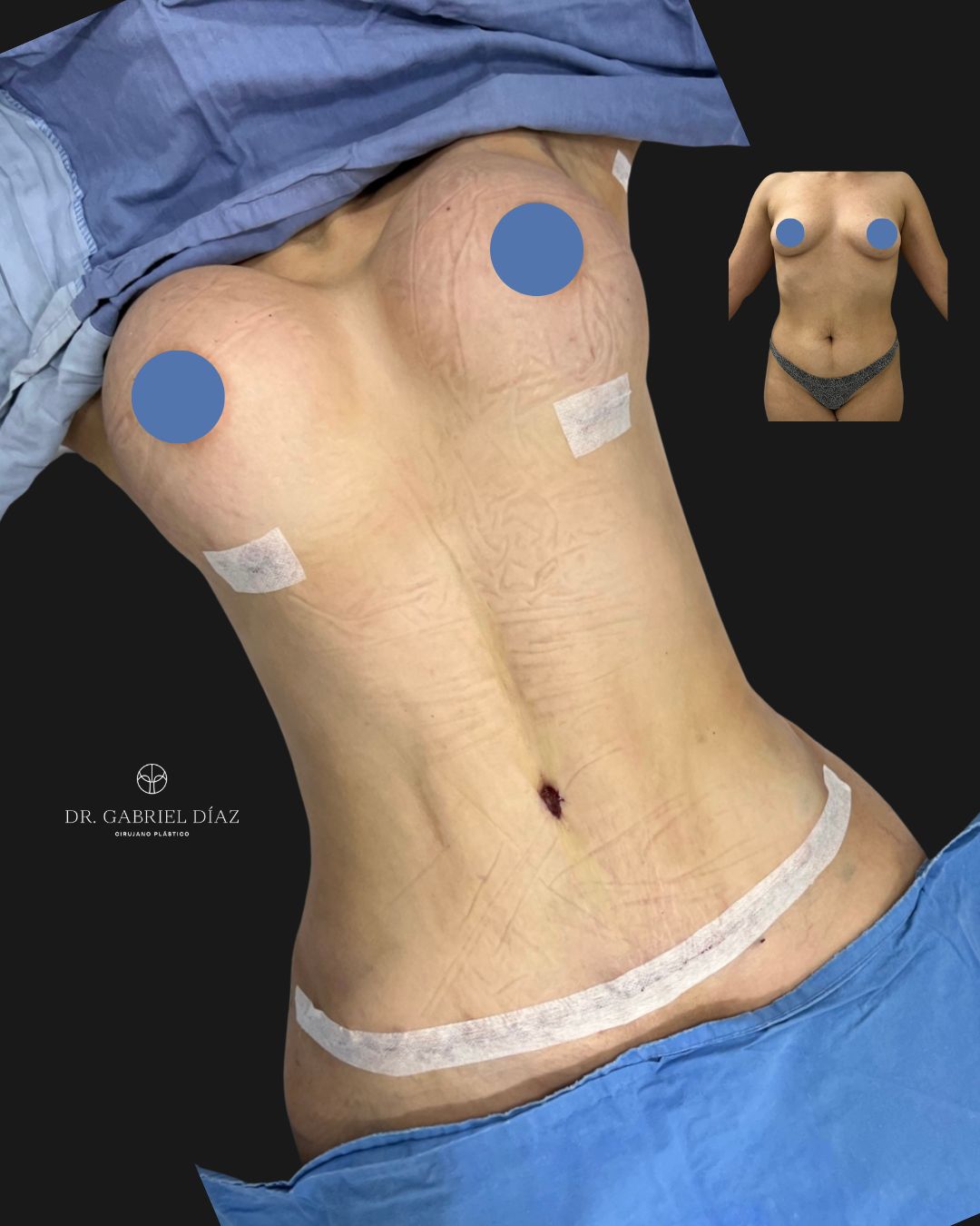 Gabriel Diaz Rosas-6