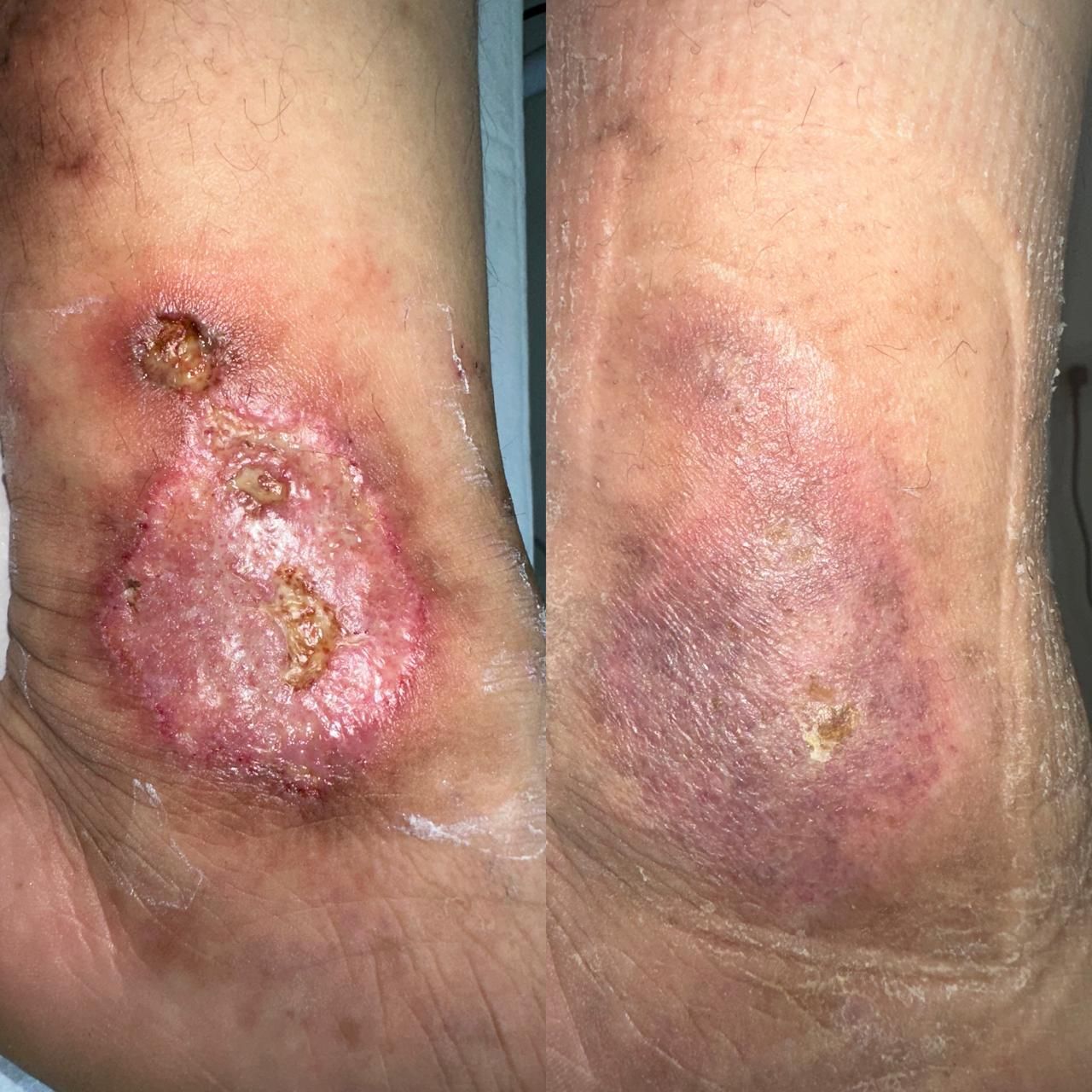 Jhonatan López González-53