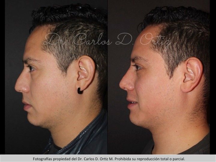 Carlos David Ortiz Moreno-5