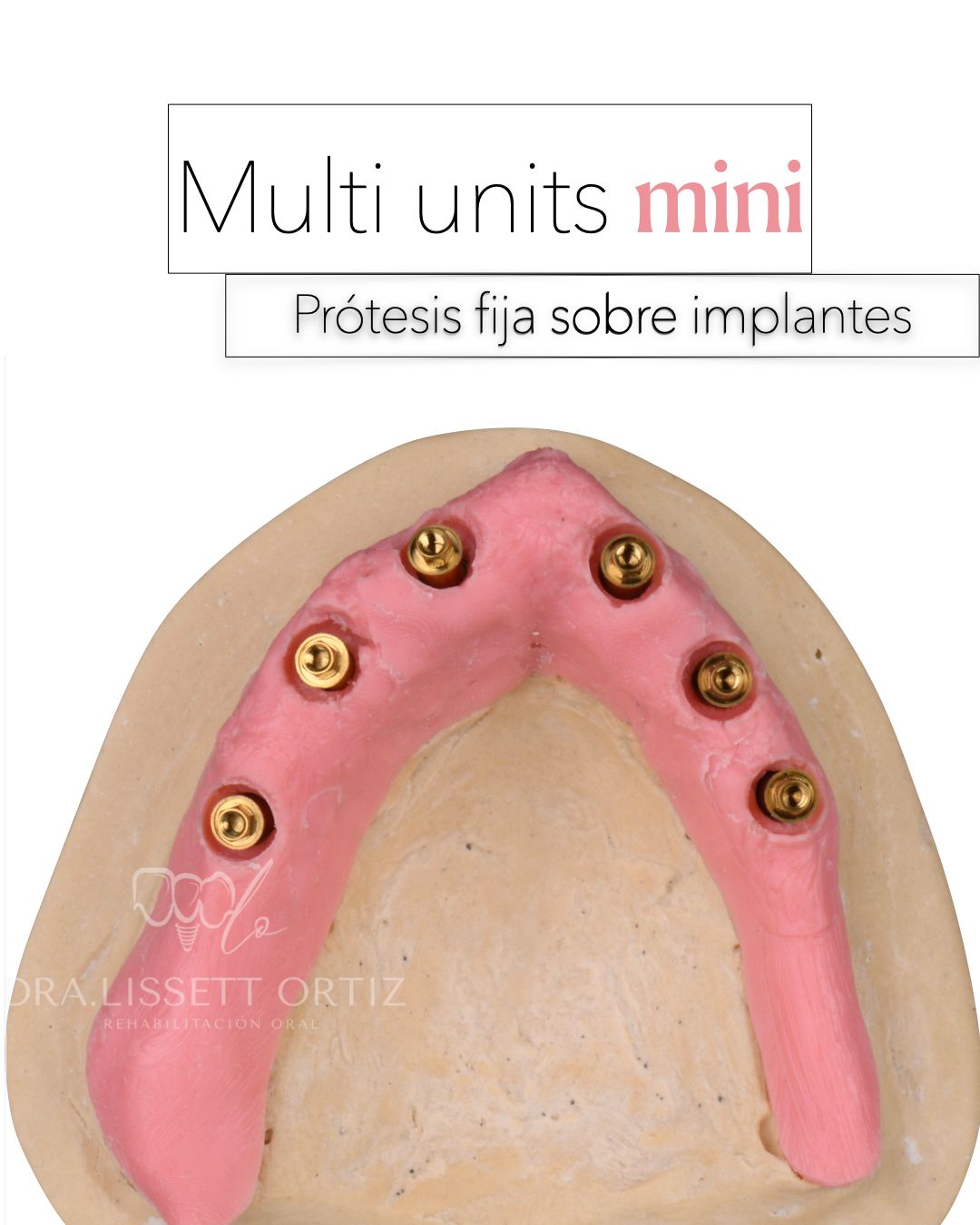 Ana Lissett Ortiz-16