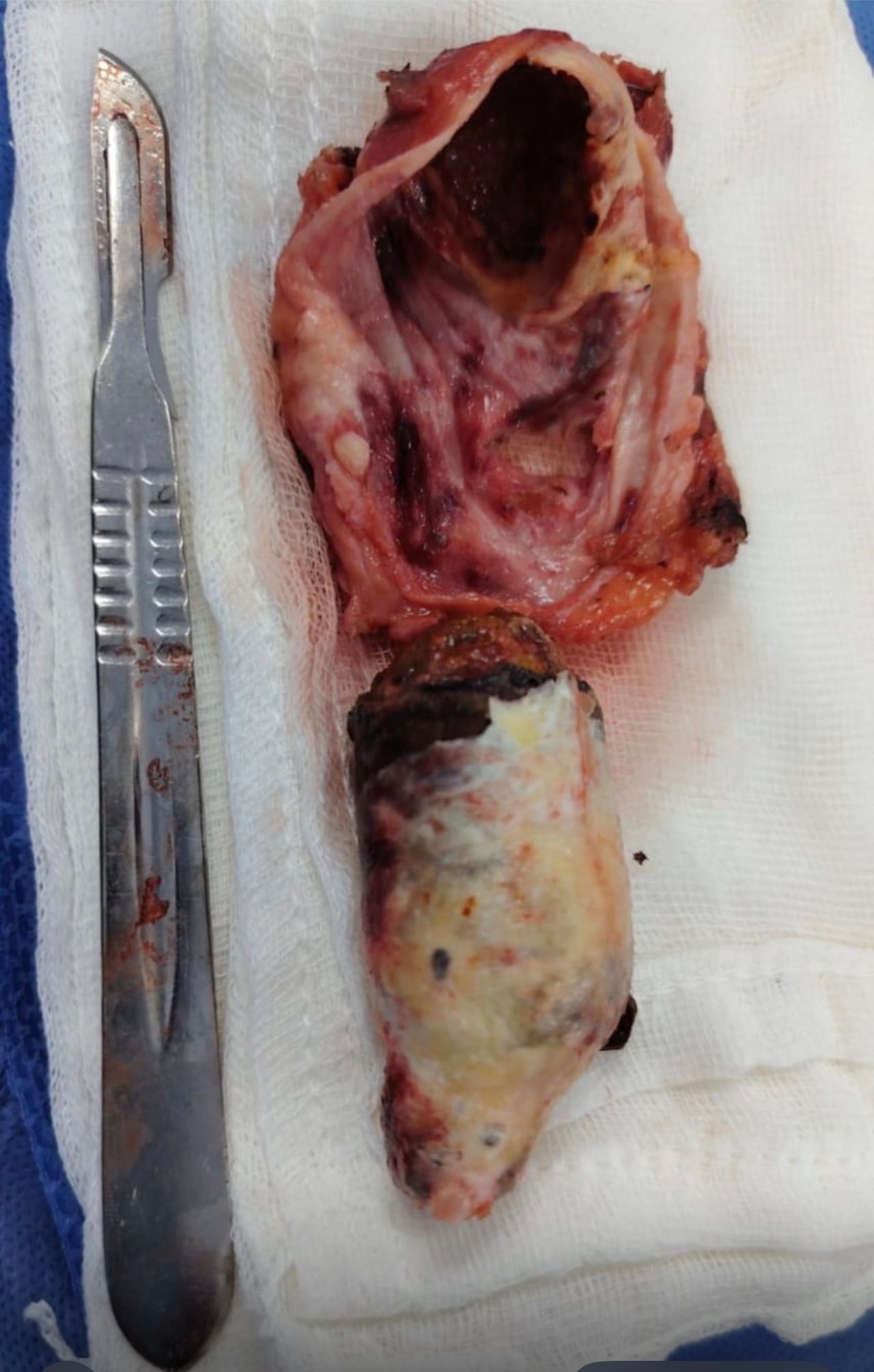 Juan Pablo Pérez Martínez-13