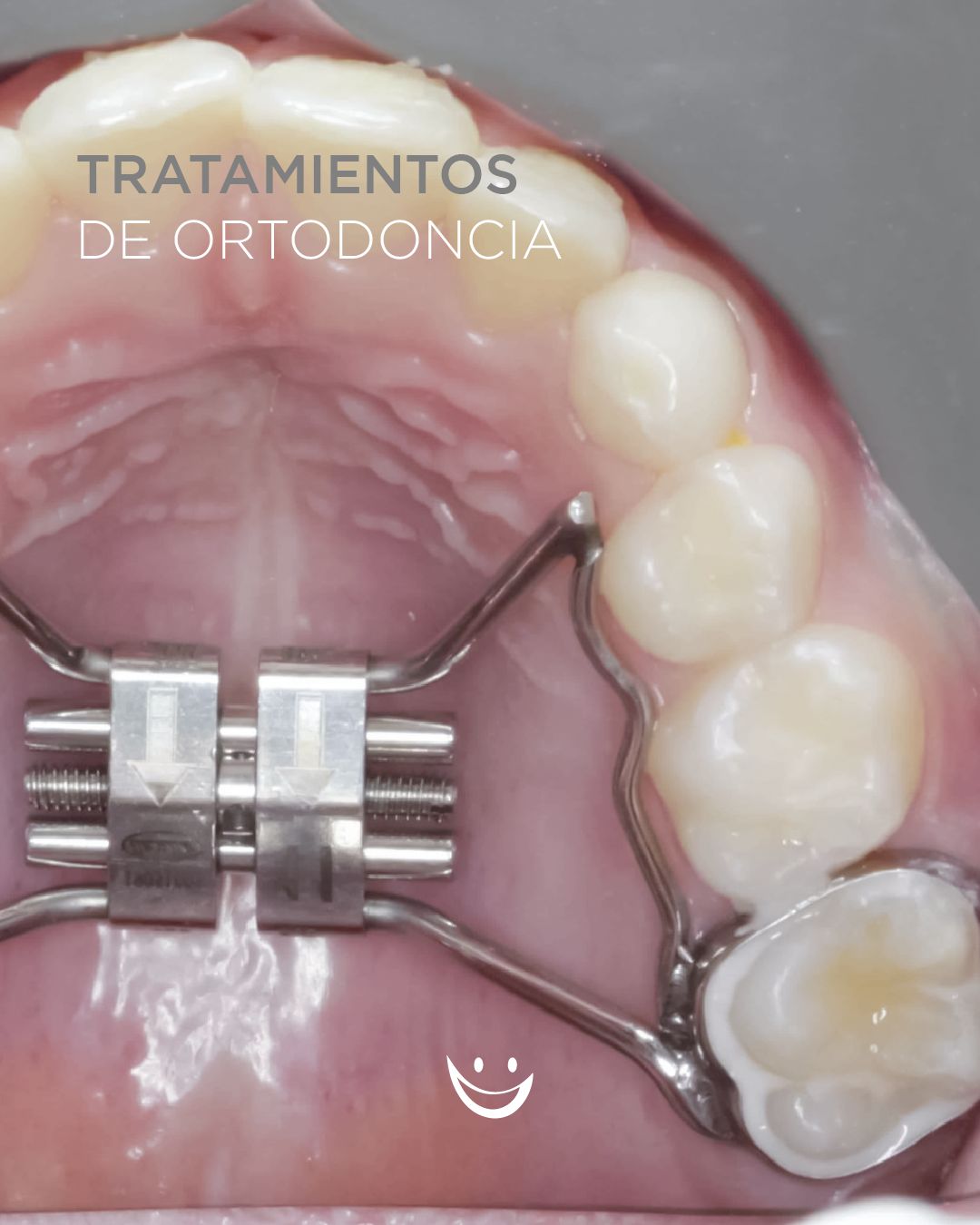 Diana De La Torre Priego-15