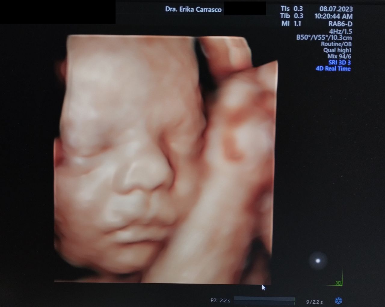 Erika Ruth Carrasco Blancas-8