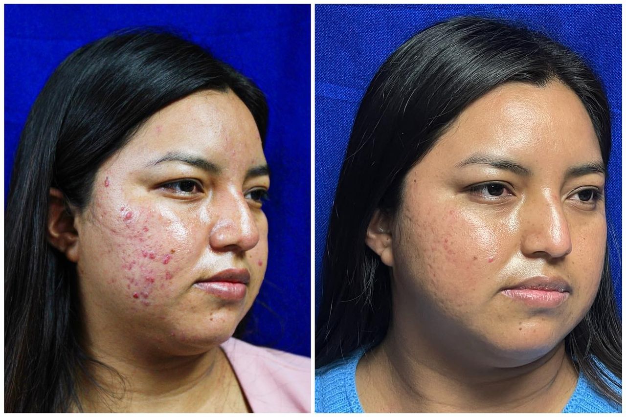 Adrián Martínez Moreno-9