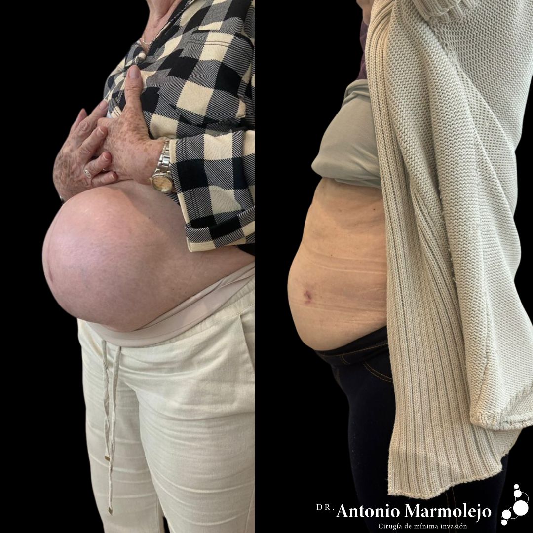 Antonio Marmolejo Chavira-8